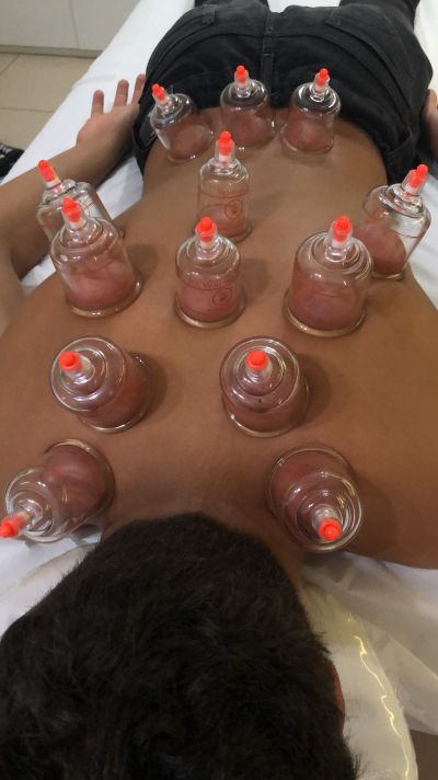 Ventosoterapia