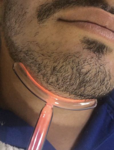 Alta frequência