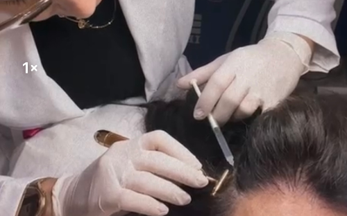 TRICOLOGIA - Alopecia Feminina/masculina