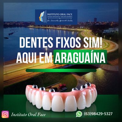 Implantes dentários