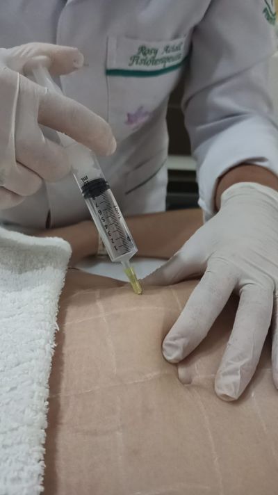 Hidrolipoclasia não aspirativa