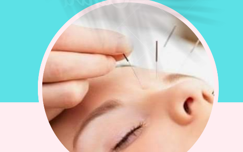Acupuntura