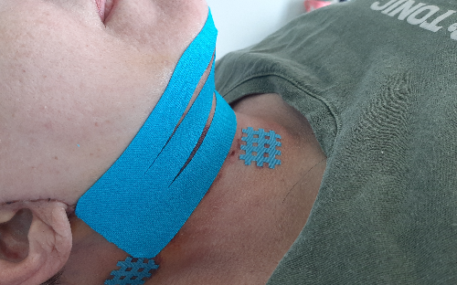 Kinesio tape