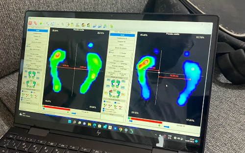 Avaliação biomecânica para análise de palmilhas