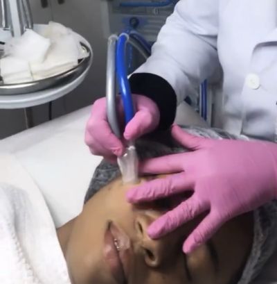 Peeling de Cristal