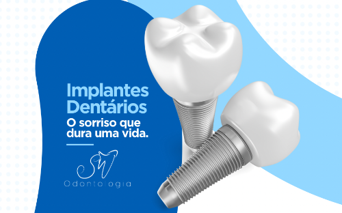 Implante dentário