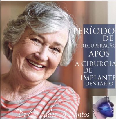 Implantes dentários