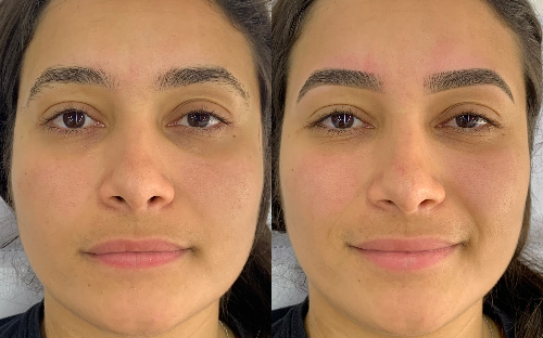 1º atendimento: DESIGN + visagismo