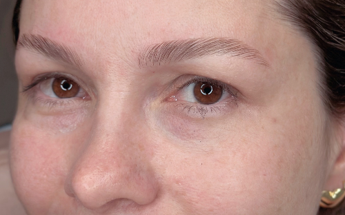 BROW LAMINATION