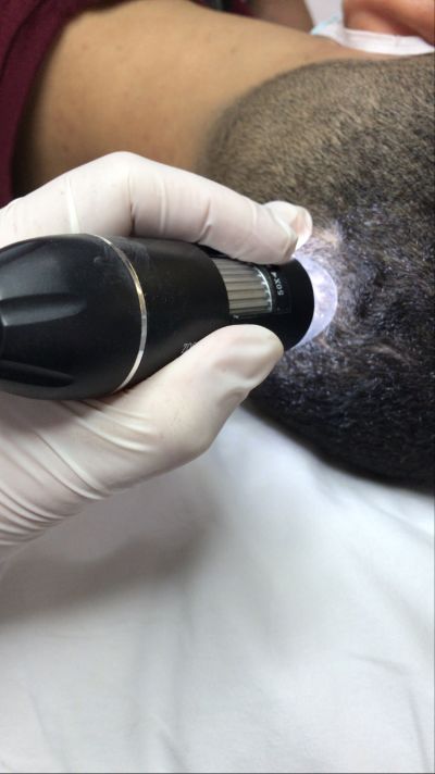 TRICOLOGIA - Alopecia Feminina/masculina