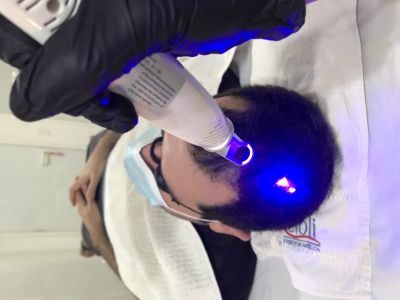 Laser PicoSure