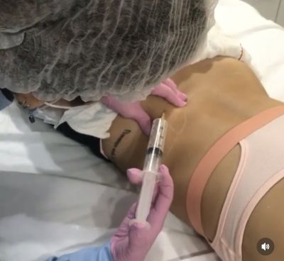 Ozônioterapia