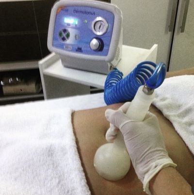 Vacuoterapia