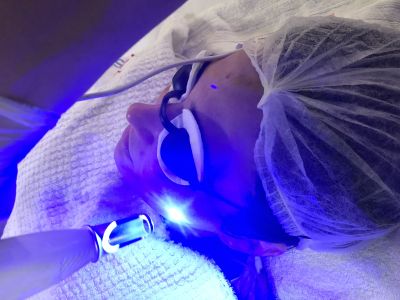Laser PicoSure