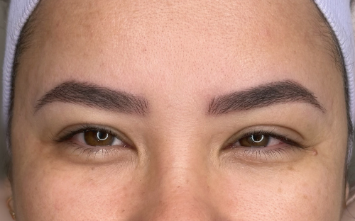 NANOBLADING (FIO A FIO)