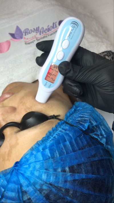 Controle do MELASMA