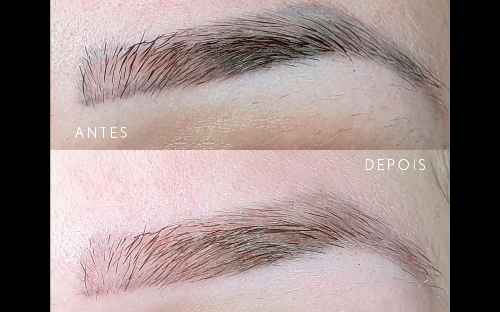 Correção de micropigmentação