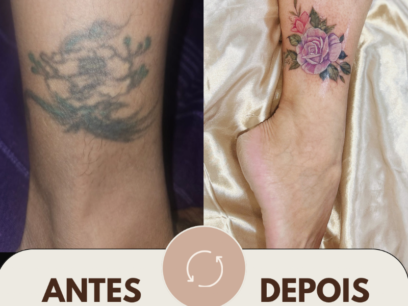 Valor mínimo de Coberturas