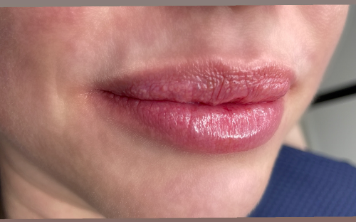 PUMP LIPS (HIDRATAÇÃO LABIAL)
