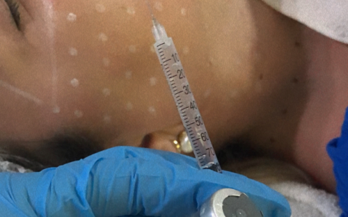 SKINBOOSTER