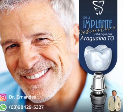Implantes dentários
