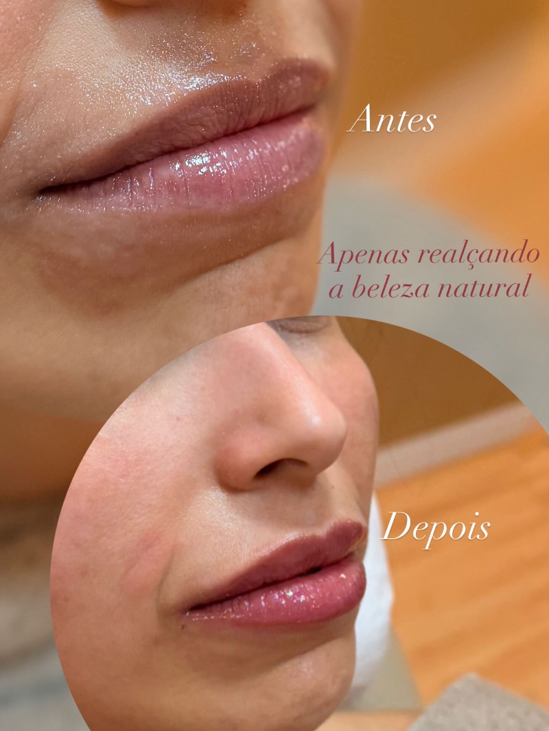 Dermatologia e estética