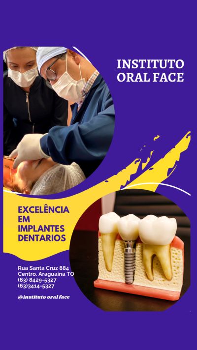 Implantes dentários