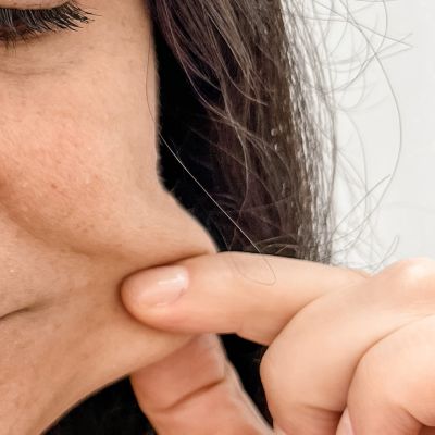 Bioestimulador de Colágeno