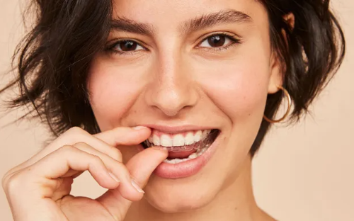 Invisalign