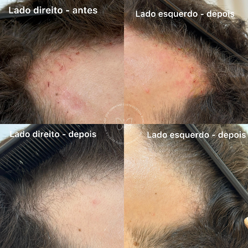 Método Cresce Fios