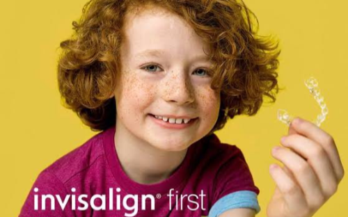Invisalign