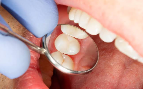 Clínica Geral e Restauração