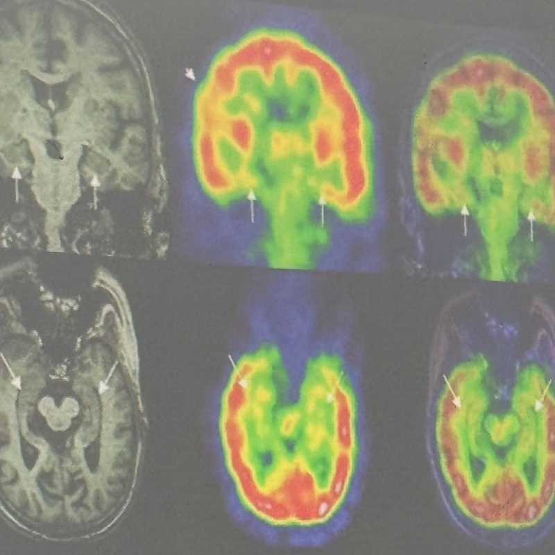 Tratamento da dor crônica