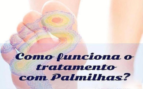 Avaliação biomecânica para análise de palmilhas