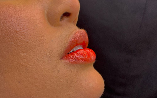 Preenchimento labial