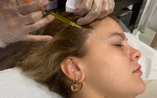 Terapia Capilar - Protocolo