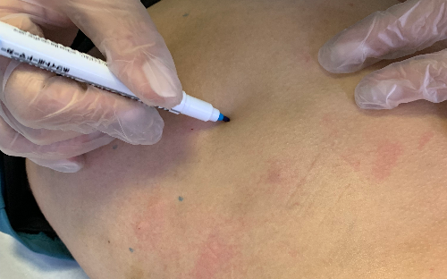 Bioestimulador de Glúteos