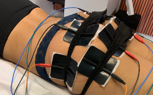 Pump up - Procedimento Glúteos