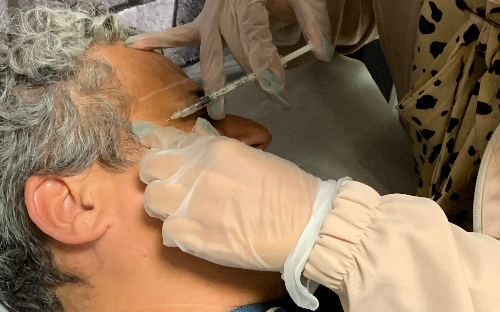 Botox Facial