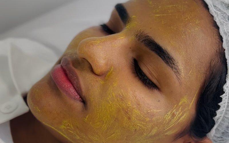 Peeling Retinóico