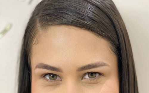 Toxina botulínica (botox)