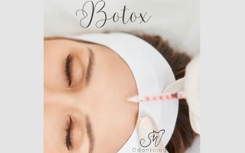 Toxina botulínica (Botox)