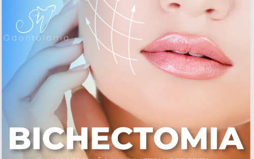 Bichectomia