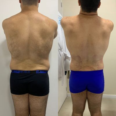 Harmonização Corporal Masculina