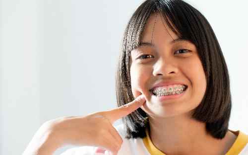 APARELHO ORTODÔNTICO