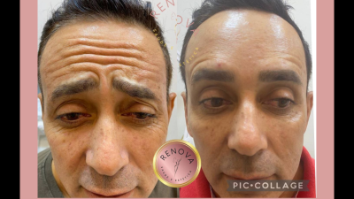 Sua beleza RENOVADA!