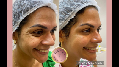 Sua beleza RENOVADA!