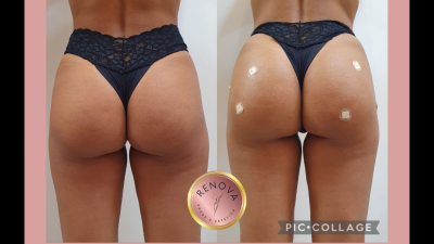 Sua beleza RENOVADA!