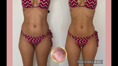 Sua beleza RENOVADA!
