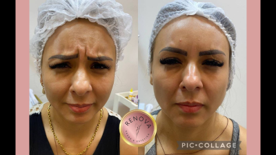 Sua beleza RENOVADA!